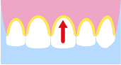 歯と歯肉の境目のイラスト画像