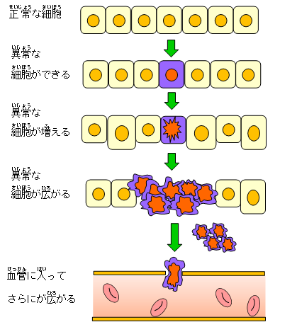 がん細胞の増え方のイラスト