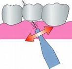 歯と歯の間を歯間ブラシを使って清掃する方法のイラスト画像