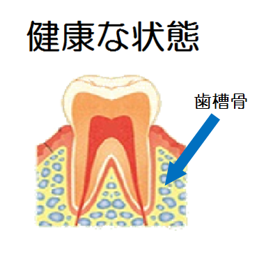 健康な歯肉のイラスト