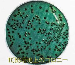 腸炎ビブリオ（TCBS培地上のコロニー）の写真