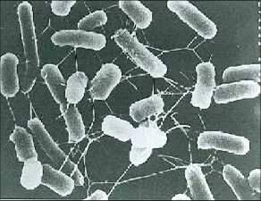 腸管出血性大腸菌（電子顕微鏡下）の写真