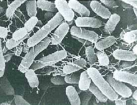 原因のサルモネラ属菌（電子顕微鏡下）の写真
