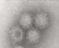 電子顕微鏡で見たノロウイルスの写真